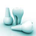 Dental Implants & Restorative