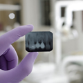 Gentle Endodontic Therapy